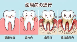 periodontal-disease.jpg