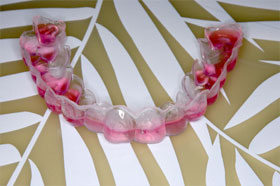 ホームホワイトニング